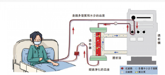 費森尤斯血液透析機：改善生活，重塑未來