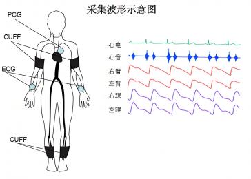 動脈硬化檢測儀的臨床意義，動脈硬化檢測儀的原理與技術(shù)！