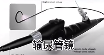 尿道鏡檢查怎么做？尿道鏡檢查的具體操作步驟