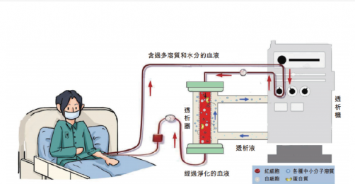 了解血液透析機的工作原理、裝置特點及應(yīng)用