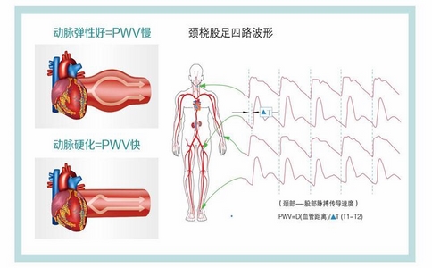 2025-02-13_動(dòng)脈硬化檢測(cè)儀_4