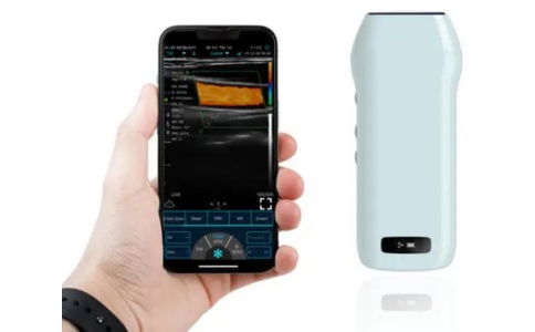 VIATOM手持式B超機(jī) C10cx